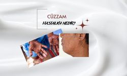 CÜZZAM HASTALIĞI NEDİR?