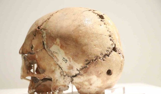 10 Bin 500 Yıl Öncesine Ait Beyin Ameliyatlı Kafatası Bulundu