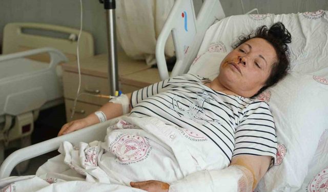 Niğde'de Başıboş Köpek Saldırısı: 54 Yaşındaki Kadın Korkunç Dakikalar Yaşadı!